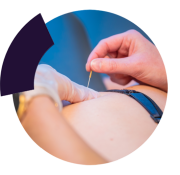 Fysio ter Harmsel / Dry-needling